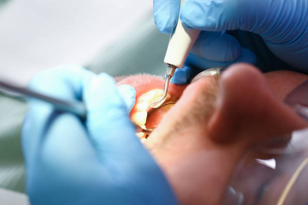 Best Emergency Gum Treatment in Center Hill, FL